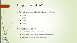 Estagiamento da AC
 AC, qdo presente classificada em estágios
 <20%
 ≥20%
 <50%
 ≥ 50%
 Dessaturação de 3%
 Associado a evento respiratório
 A partir do valor imediato prévio a hipopneia
 Nadir até 30” do término do evento
 