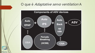 O que é Adaptative servo ventilation A
 