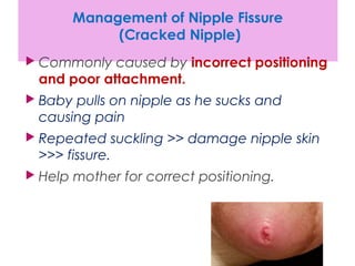 Sesi 12 Breast and nipple conditions