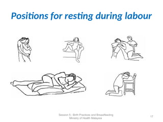 Positions for resting during labour
17
Session 5 : Birth Practices and Breastfeeding
Ministry of Health Malaysia
 