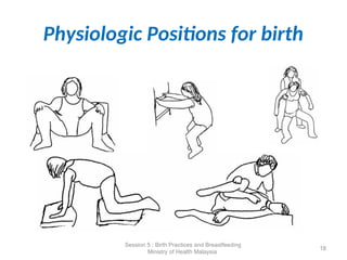 Physiologic Positions for birth
18
Session 5 : Birth Practices and Breastfeeding
Ministry of Health Malaysia
 