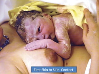 UNICEF/WHO Breastfeeding Promotion and Support in a Baby-Friendly Hospital – 20 hour Course 2006
First Skin to Skin Contact
5/3
Dr
Nils
Bergman,
Cape
Town,
South
Africa
31
First Skin to Skin Contact
 