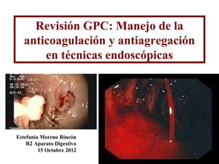 Revisión GPC: Manejo de la
   anticoagulación y antiagregación
       en técnicas endoscópicas




Estefanía Moreno Rincón
    R2 Aparato Digestivo
         15 Octubre 2012
 
