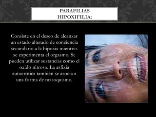 Consiste en el deseo de alcanzar
un estado alterado de conciencia
secundario a la hipoxia mientras
se experimenta el orgasmo. Se
pueden utilizar sustancias como el
oxido nitroso. La asfixia
autoerótica también se asocia a
una forma de masoquismo.
PARAFILIAS
HIPOXIFILIA:
 