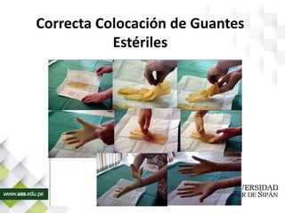 Correcta Colocación de Guantes
Estériles
 