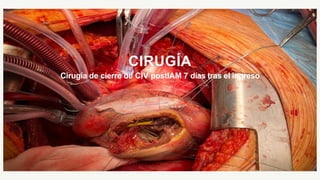CIRUGÍA
Cirugía de cierre de CIV postIAM 7 días tras el ingreso
 