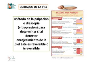 SESIÓN CLINICA PREVENCIÓN UPP 2021.pdf