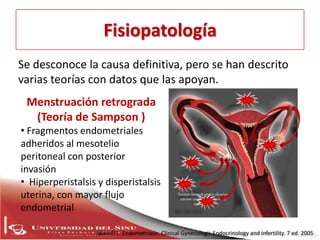 endometriosis Slide 5