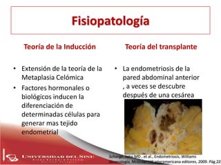 endometriosis Slide 7