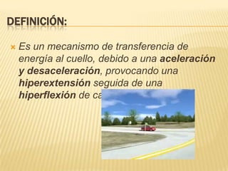 DEFINICIÓN:

   Es un mecanismo de transferencia de
    energía al cuello, debido a una aceleración
    y desaceleración,...