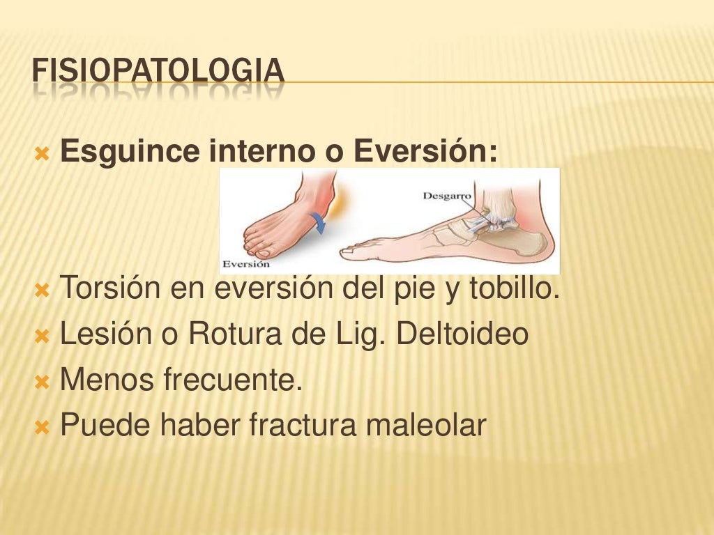 Sesión clínica esguince de tobillo 15.03.2012