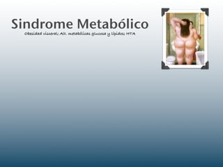 Sindrome Metabólico
 Obesidad visceral; Alt. metabólicas glucosa y lípidos; HTA
 