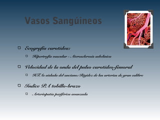 Vasos Sangúineos
Ecografía carotídea:
Hipertrofia vascular - Aterosclerosis subclínica
Velocidad de la onda del pulso carotídeo-femoral
HTAs aislada del anciano: Rigidez de las arterias de gran calibre
Indice PA tobillo-brazo
Arteriopatía periférica avanzada
 