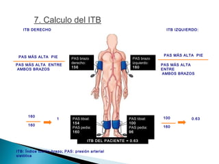 PAS brazo
izquierdo:
160
PAS brazo
derecho:
156
PAS tibial:
100
PAS pedia:
96
PAS tibial:
154
PAS pedia:
160
ITB DERECHO
PAS MÁS ALTA ENTRE
AMBOS BRAZOS
PAS MÁS ALTA PIE
160
160
ITB IZQUIERDO:
100
160
0.63
ITB DEL PACIENTE = 0.63
1
PAS MÁS ALTA
ENTRE
AMBOS BRAZOS
PAS MÁS ALTA PIE
ITB: Índice tobillo-brazo; PAS: presión arterial
sistólica
7. Calculo del ITB
 