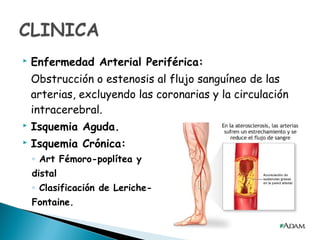  Enfermedad Arterial Periférica:
Obstrucción o estenosis al flujo sanguíneo de las
arterias, excluyendo las coronarias y la circulación
intracerebral.
 Isquemia Aguda.
 Isquemia Crónica:
◦ Art Fémoro-poplítea y
distal
◦ Clasificación de Leriche-
Fontaine.
 