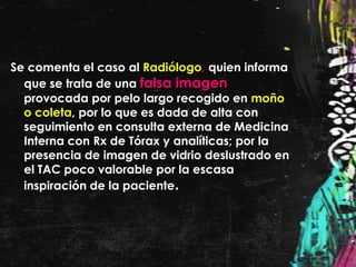 Se comenta el caso al Radiólogo, quien informa
  que se trata de una falsa imagen
  provocada por pelo largo recogido en moño
  o coleta, por lo que es dada de alta con
  seguimiento en consulta externa de Medicina
  Interna con Rx de Tórax y analíticas; por la
  presencia de imagen de vidrio deslustrado en
  el TAC poco valorable por la escasa
  inspiración de la paciente.
 