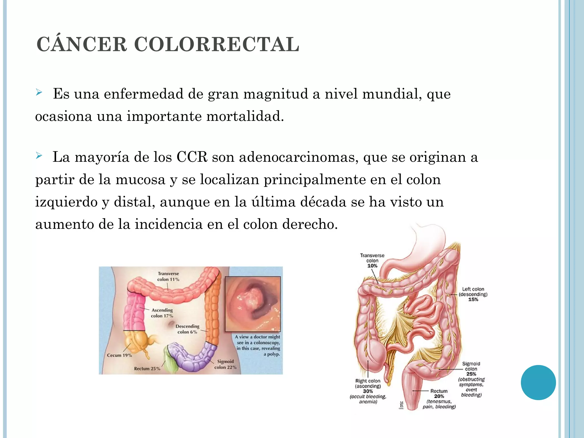 Sesión cáncer de colon | PPT