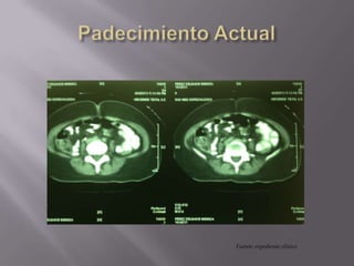 Fuente: expediente clínico
 