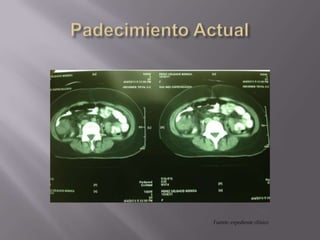 Fuente: expediente clínico
 