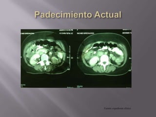Fuente: expediente clínico
 