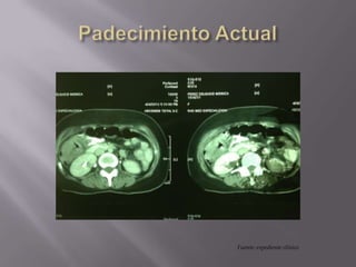 Fuente: expediente clínico
 