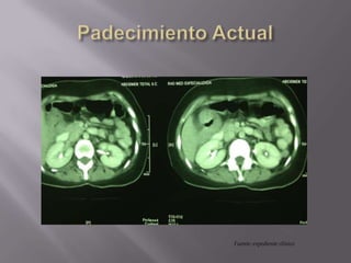 Fuente: expediente clínico
 