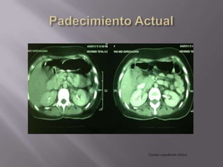 Fuente: expediente clínico
 