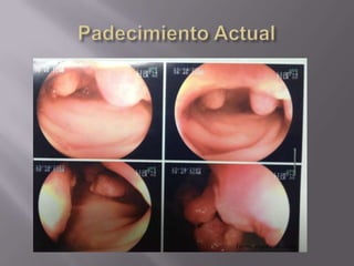 Fuente: expediente clínico
 