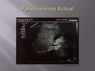Fuente: expediente clínico
 
