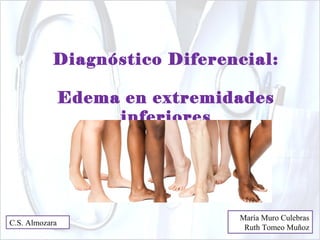 Diagnóstico Diferencial: 
Edema en extremidades 
inferiores 
María Muro Culebras 
C.S. Almozara Ruth Tomeo Muñoz 
 