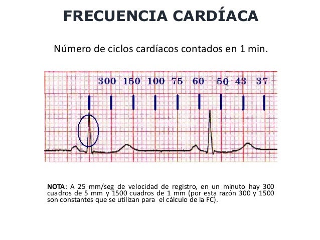 Curso Electrocardiografia Curso Electrocardiografia