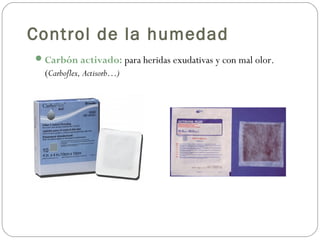 Control de la humedad
Carbón activado: para heridas exudativas y con mal olor.
(Carboflex, Actisorb…)
 