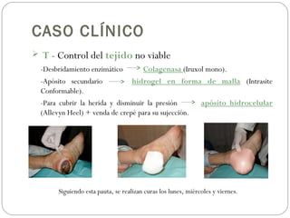 CASO CLÍNICO
 T - Control del tejido no viable
-Desbridamiento enzimático Colagenasa (Iruxol mono).
-Apósito secundario hidrogel en forma de malla (Intrasite
Conformable).
-Para cubrir la herida y disminuir la presión apósito hidrocelular
(Allevyn Heel) + venda de crepé para su sujección.
Siguiendo esta pauta, se realizan curas los lunes, miércoles y viernes.
 