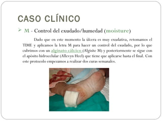 CASO CLÍNICO
 M - Control del exudado/humedad (moisture)
Dado que en este momento la úlcera es muy exudativa, retomamos el
TIME y aplicamos la letra M para hacer un control del exudado, por lo que
cubrimos con un alginato cálcico (Algisite M) y posteriormente se sigue con
el apósito hidrocelular (Allevyn Heel) que tiene que aplicarse hasta el final. Con
este protocolo empezamos a realizar dos curas semanales.
 
