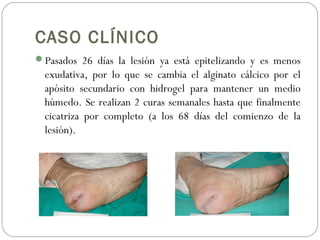 CASO CLÍNICO
Pasados 26 días la lesión ya está epitelizando y es menos
exudativa, por lo que se cambia el alginato cálcico por el
apósito secundario con hidrogel para mantener un medio
húmedo. Se realizan 2 curas semanales hasta que finalmente
cicatriza por completo (a los 68 días del comienzo de la
lesión).
 