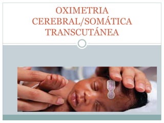 OXIMETRIA
CEREBRAL/SOMÁTICA
TRANSCUTÁNEA
 
