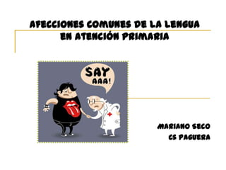 Afecciones Comunes de la Lengua
en Atención Primaria
Mariano Seco
Cs Paguera
 