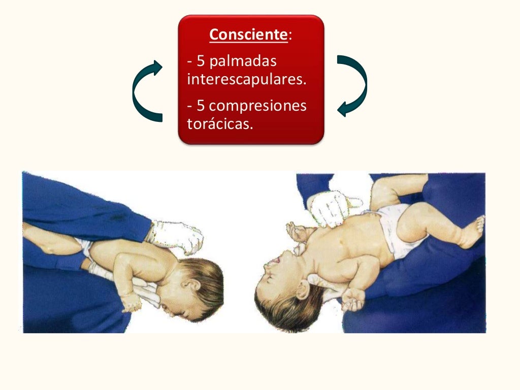 RCP básica, DEA y OVACE en niños y lactantes. AHA 2015