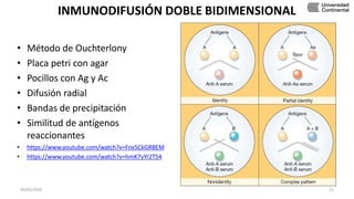 INMUNODIFUSIÓN DOBLE BIDIMENSIONAL
• Método de Ouchterlony
• Placa petri con agar
• Pocillos con Ag y Ac
• Difusión radial
• Bandas de precipitación
• Similitud de antígenos
reaccionantes
• https://www.youtube.com/watch?v=Fnx5CkGRBEM
• https://www.youtube.com/watch?v=hmK7yYr2T54
30/05/2020 21
 