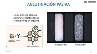 AGLUTINACIÓN PASIVA
• Empleo de una partícula
aglutinante inerte a la cual
se le ha unido un antígeno
30/05/2020 29
 