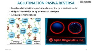 AGLUTINACIÓN PASIVA REVERSA
• Basada en la inmovilización del Ac en la superficie de la partícula inerte
• Útil para la detección de Ag en muestras biológicas
• Anticuerpos monoclonales
30/05/2020 32
 