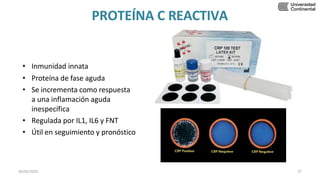 PROTEÍNA C REACTIVA
• Inmunidad innata
• Proteína de fase aguda
• Se incrementa como respuesta
a una inflamación aguda
inespecífica
• Regulada por IL1, IL6 y FNT
• Útil en seguimiento y pronóstico
30/05/2020 37
 