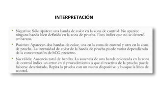 INTERPRETACIÓN
 