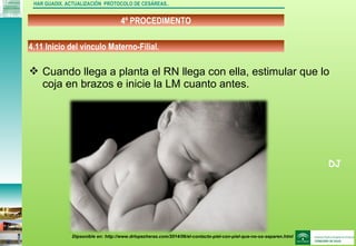 DJ
4º PROCEDIMENTO
HAR GUADIX. ACTUALIZACIÓN PROTOCOLO DE CESÁREAS..
 Cuando llega a planta el RN llega con ella, estimular que lo
coja en brazos e inicie la LM cuanto antes.
4.11 Inicio del vínculo Materno-Filial.
Dipsonible en: http://www.drlopezheras.com/2014/06/el-contacto-piel-con-piel-que-no-os-separen.html
 
