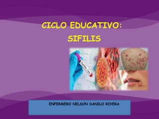 ITS
CICLO EDUCATIVO:
ENFERMERO NELSON DANILO RIVERA
SIFILIS
 