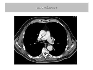 CASO CLÍNICO 2

 