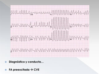 

Diagnóstico y conducta…



FA preexcitada  CVE

 