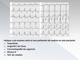 Indique cual examen seria el mas pertinente de realizar en este paciente:
a) Troponinas.
b) AngioTAC de Tórax.
c) Coronariografía de urgencia.
d) Dimero D
e) TAC de cerebro

 