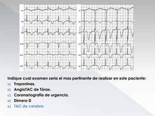 Indique cual examen seria el mas pertinente de realizar en este paciente:
a) Troponinas.
b) AngioTAC de Tórax.
c) Coronariografía de urgencia.
d) Dimero D
e) TAC de cerebro

 
