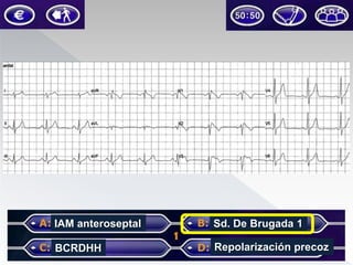 IAM anteroseptal

Sd. De Brugada 1

BCRDHH

Repolarización precoz

 